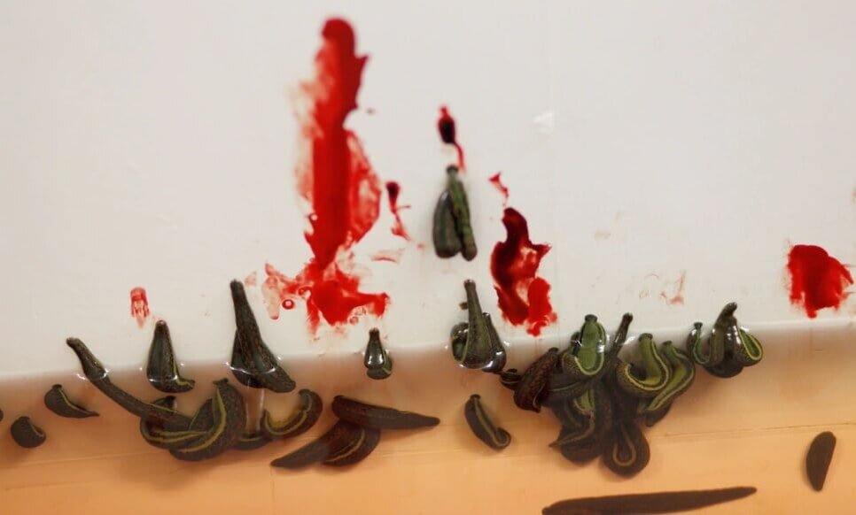    Пиявки активно применяются в современной медицине