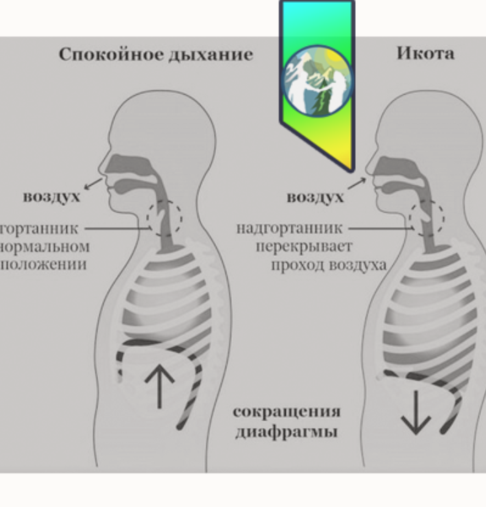 Почему икота