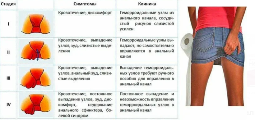 Кровотечение из геморроидальных узлов карта вызова