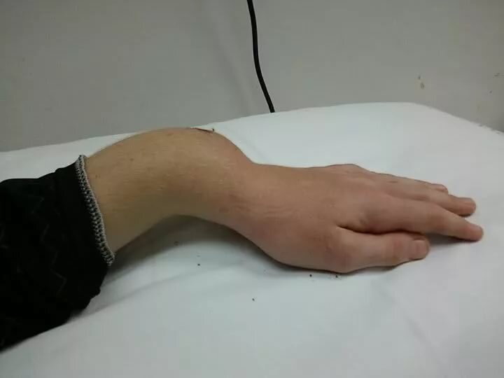 -2-3