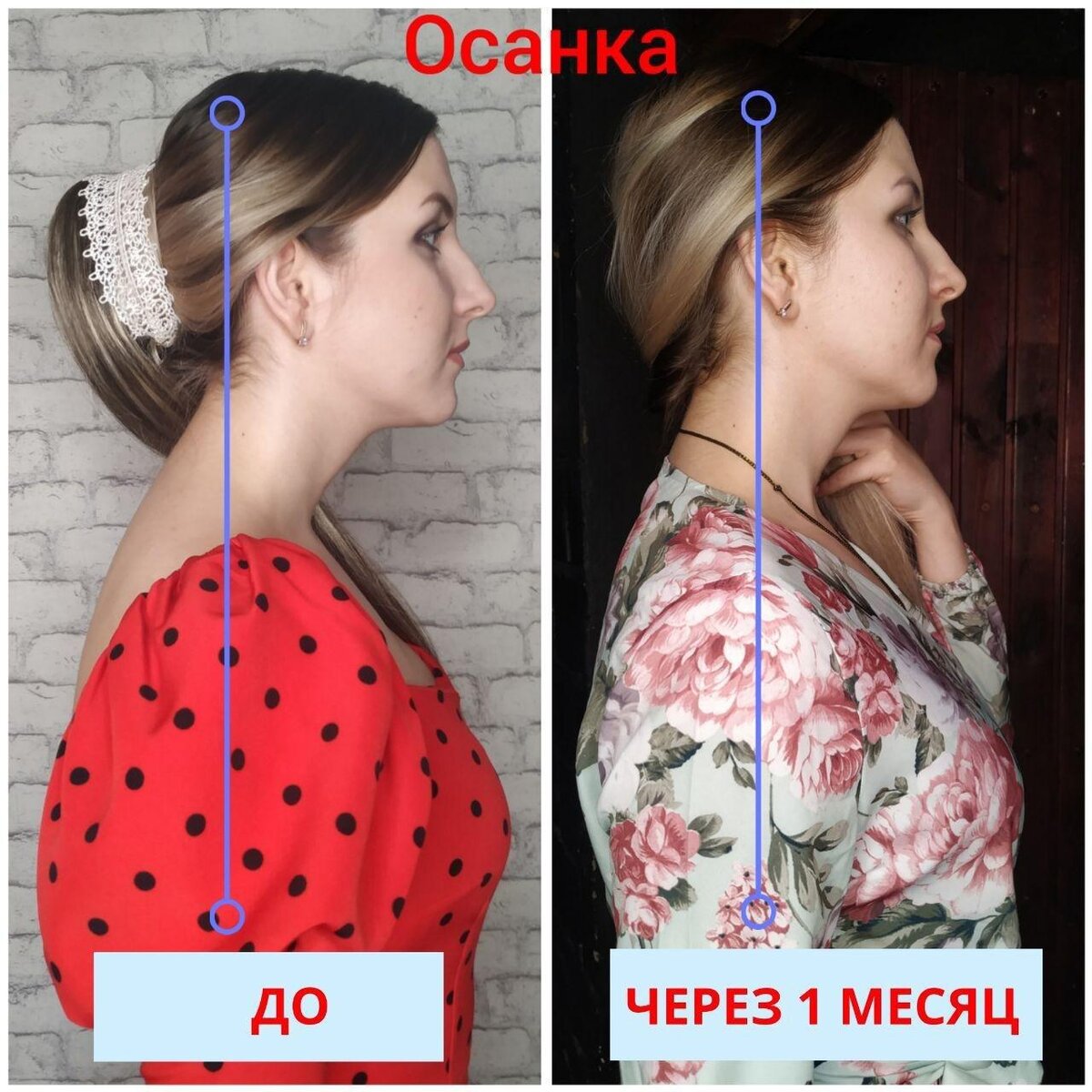 Второй подбородок из за осанки. Второй подбородок из за осанки