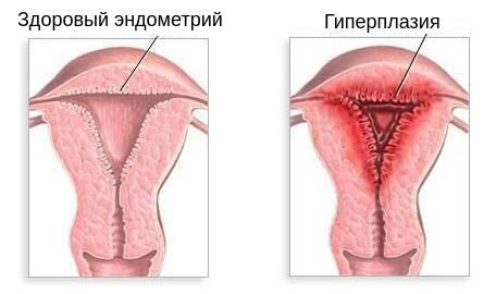 Лечение бесплодия в Чертаново на Академика Янгеля в ЮАО