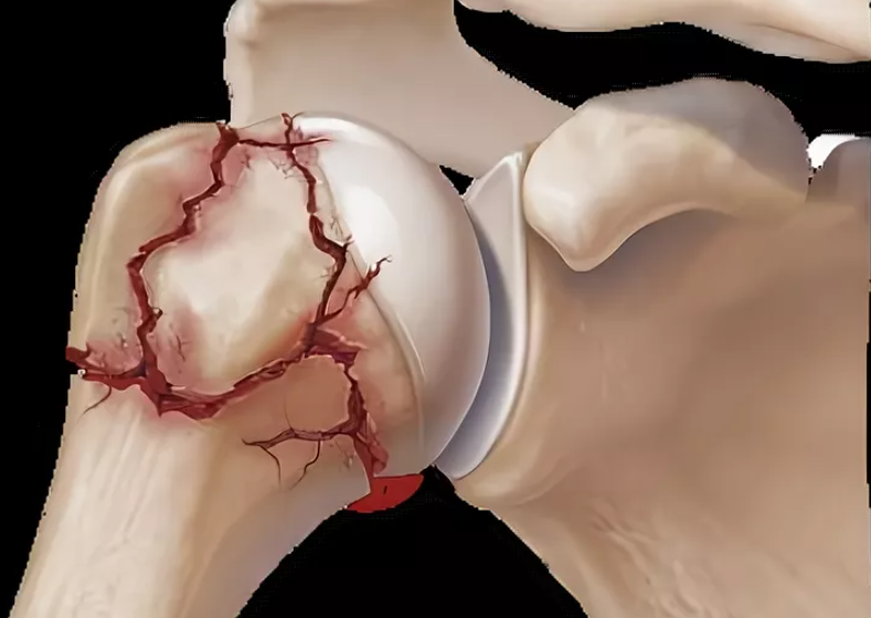 Торговля с плечом