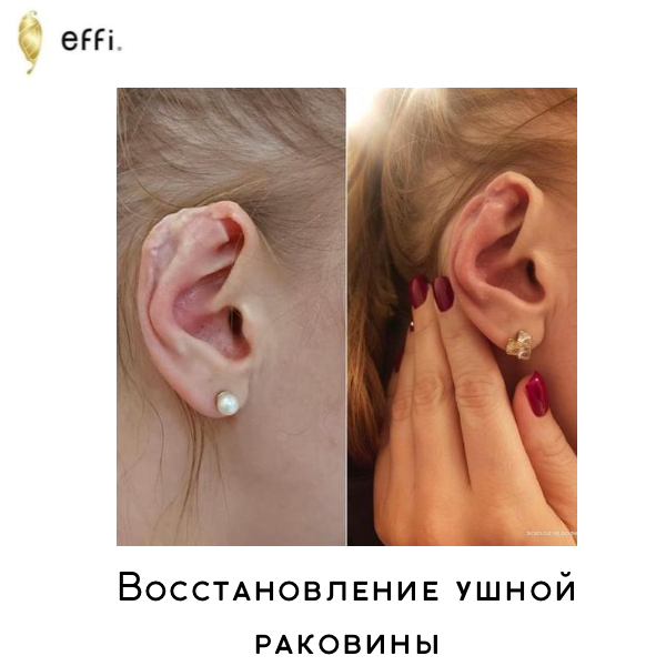 Пластический хирург клиники effi Андриянова И.В.