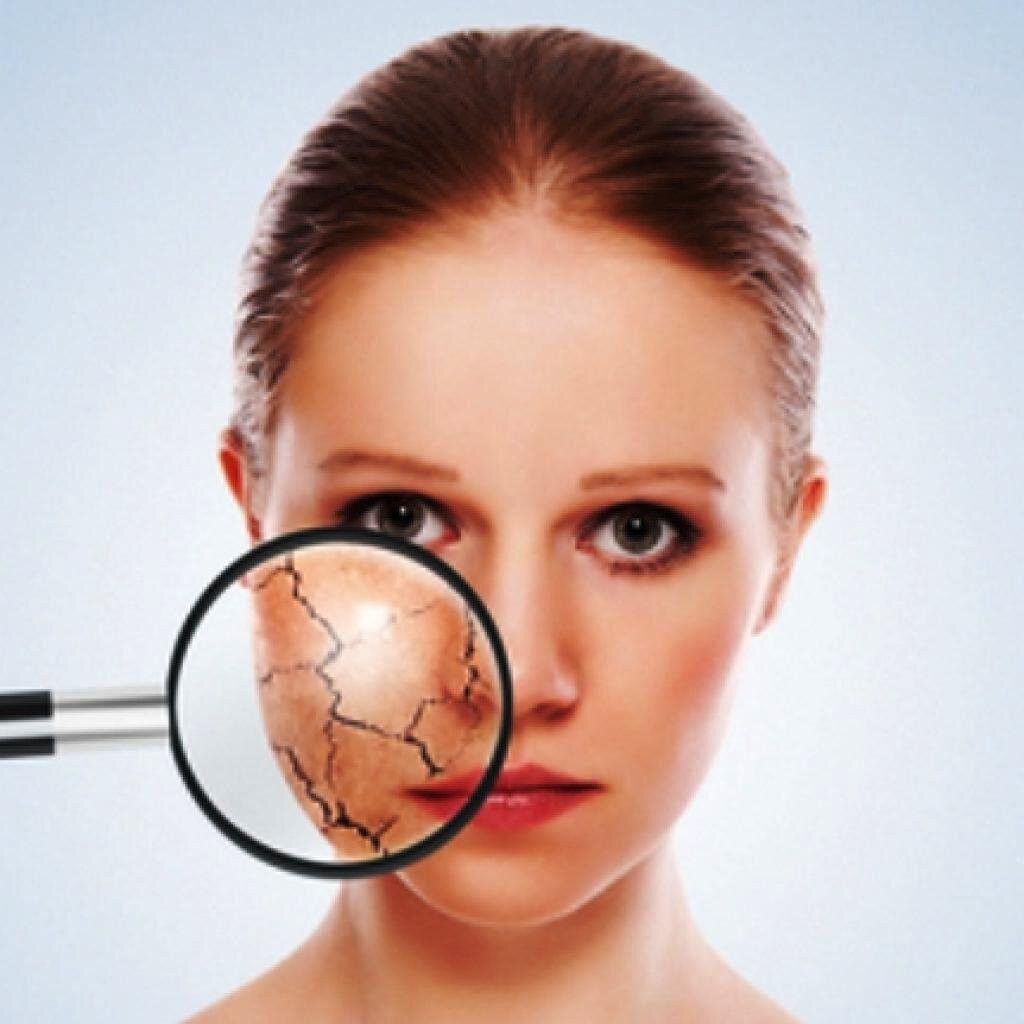 Гиперчувствительной коже можно помочь