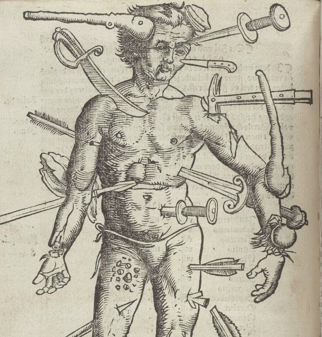 Немного поранился в бою... Не забывайте подписываться на канал и ставить "пальцы вверх"