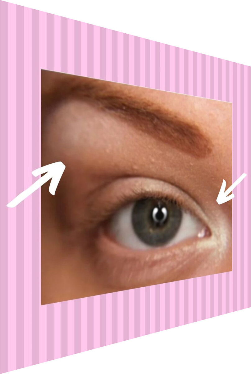 Белые тени в уголке глаз