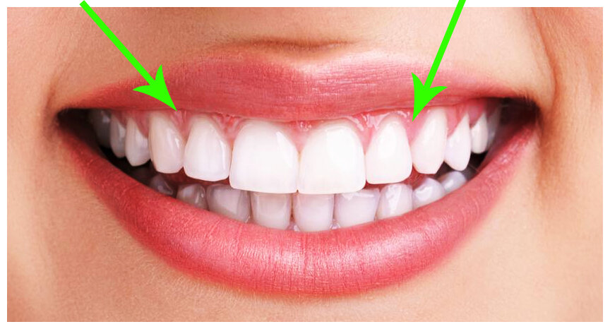 Здоровая десна.