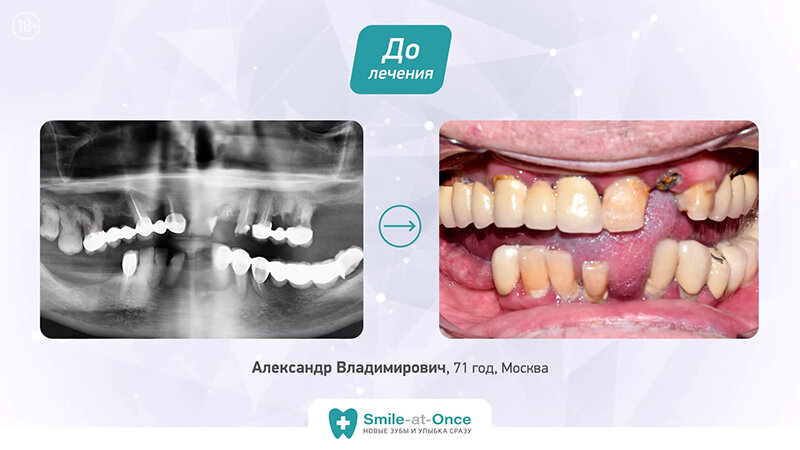 С такой ситуацией пациент к нам обратился.