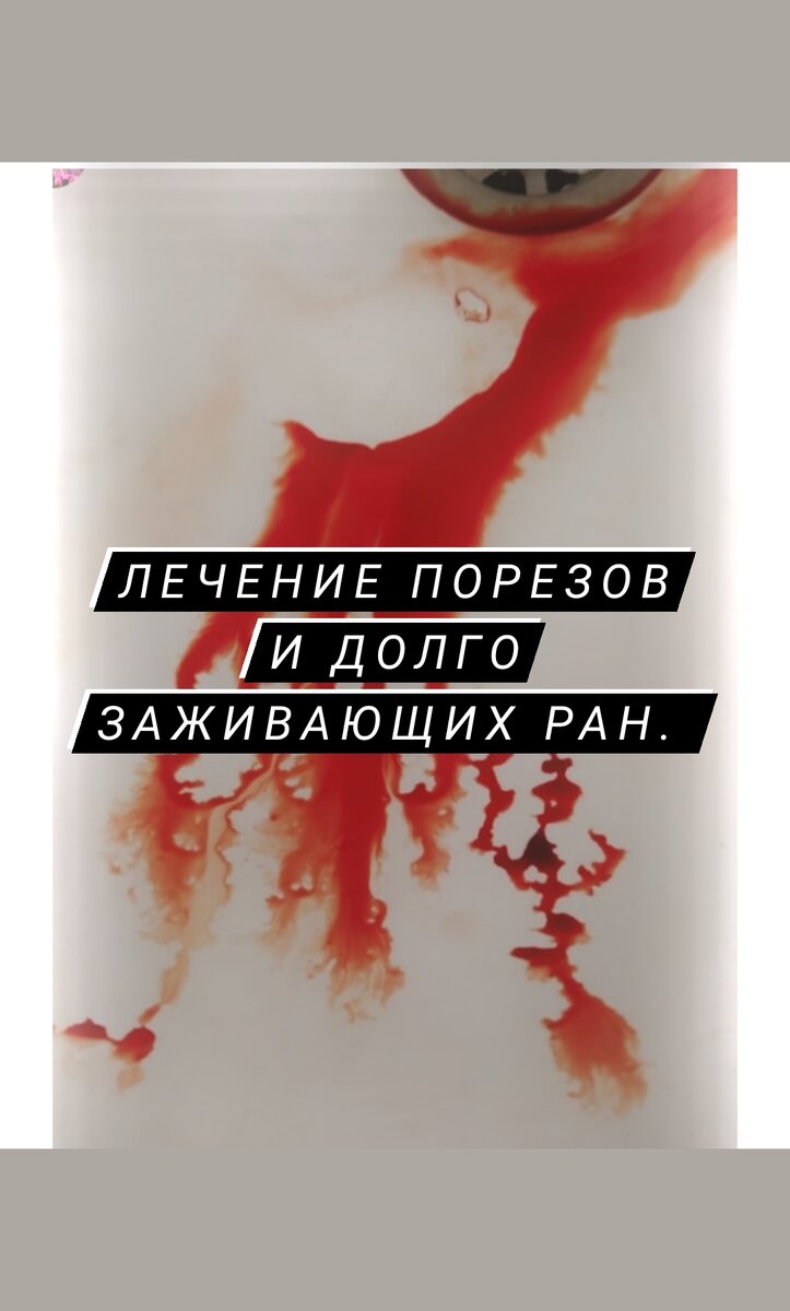 На место пореза и долго заживающих ран нанесите мазь пантенол, обладающий ускорением регенерации тканей. При каждой смене пластыря(лучше использовать лейкопластырь верофарм) обрабатывайте мирамистином или фурациллином, затем наносите мазь и залепляйте пластырем. Пантенол можно чередовать с другими мазями: левомиколь, метилурацил, стелланин-ПЭГ. При долгом нагноении используйте примочки на ночь из гипертонического раствора соли, который приготовляете сами: на пол стакана кипятка, добавляете 1чайную ложку соли и как раствор немного остынет, чтобы терпела рука, но ещё он был горячим, поместите в стакан (или поллитровую банку) марлю из восьми слоёв, это важно. Отожмите её и приложите на рану. Обматайте тряпкой, НЕ целлофаном! Примочку делайте на ночь, а все мази наносите днём.Помните, что все глубокие порезы зашиваются в первые 24 часа, на второй день их зашивать нельзя и в больнице вам откажут в этом.Другие полезные советы вы найдёте на моём канале  "приусадебный участок" YouTube, в плейлисте помощь по дому. Ссылка первая, в шапке профиля. 