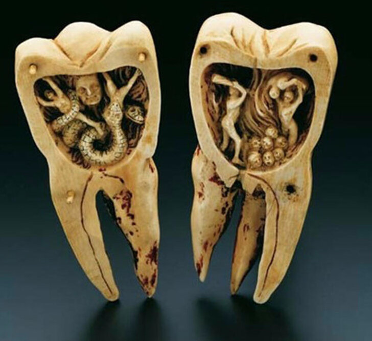 Зубы разрушаются по грехам. Если имеется киста, то на кого-то ты имеешь сильную злобу с молодости, кто тебя обидел и ты его возненавидела. И все это зло в деснах, разрушая зубы.