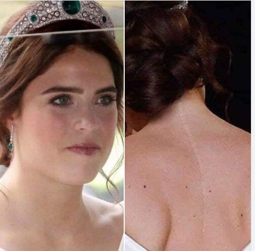 На что, она ответила: Я окончила Оксфорд, защитила докторскую диссертацию в трех разных областях. Я знаю 5 языков. И вы говорите мне о шрамах и дефектах старой операции. Гордиться или стыдиться следует только своим умом. Больше ни в чем другом. Я сделала это, чтобы отблагодарить медработников и призвать девушек не стыдиться каких-либо эстетических изъянов на своем теле. Ваша истинная красота в вашей морали, человечности и доброте.