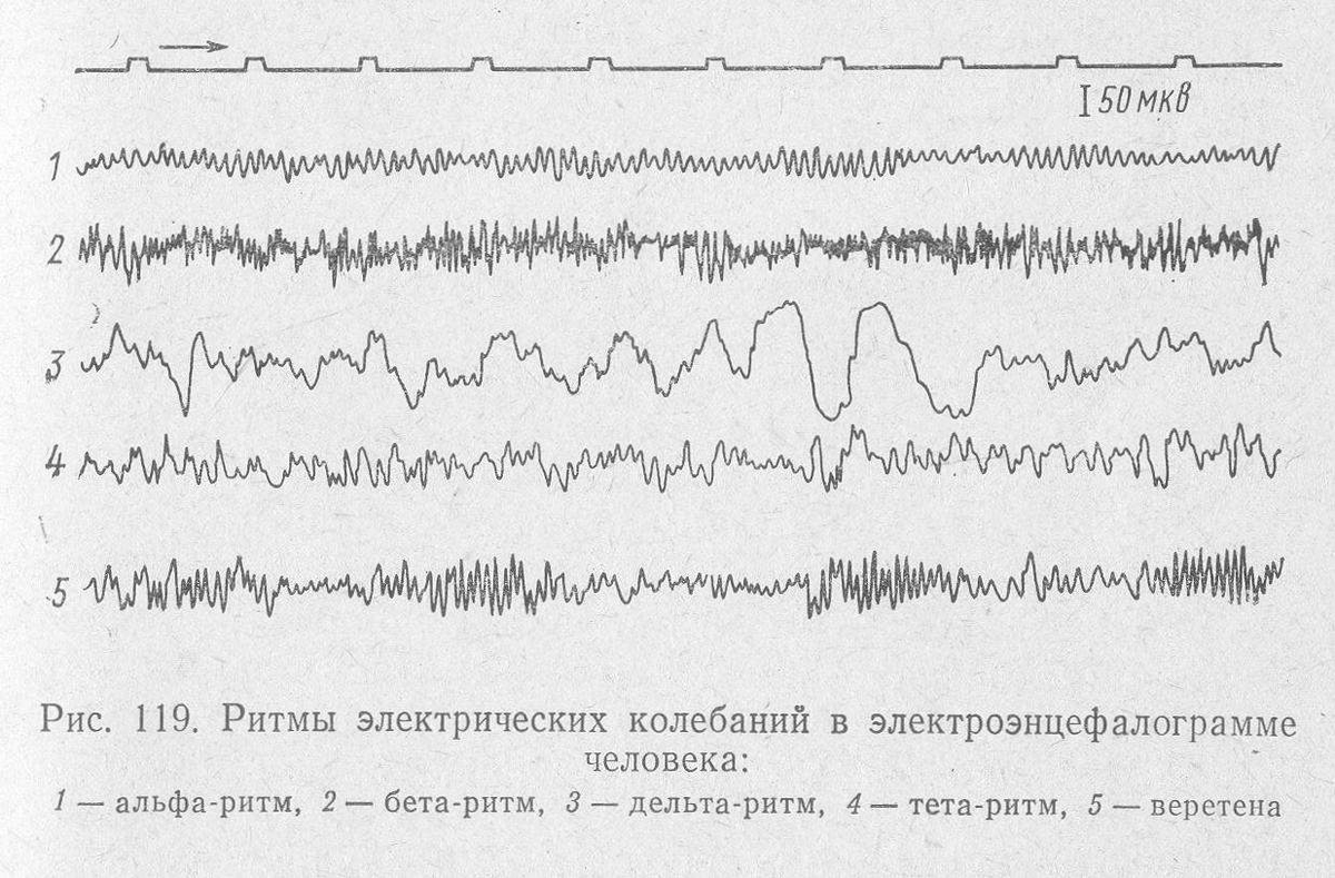 Здесь указаны основные ритмы ЭЭГ 