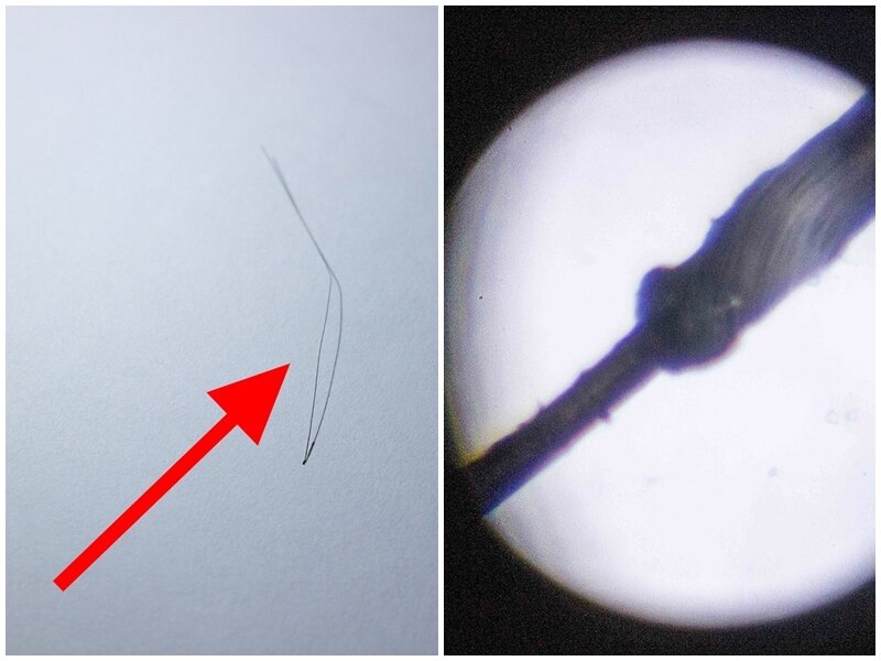 Корень волоска