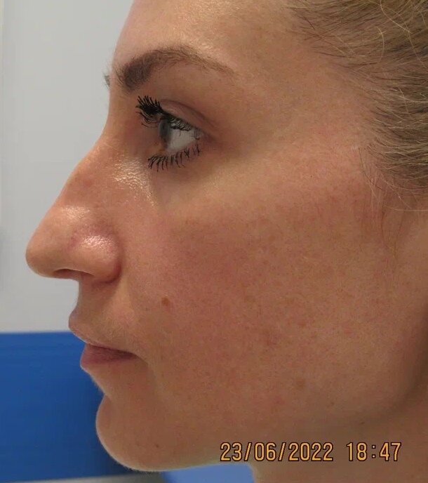 Мне не понравилась носогубка и брыли) 