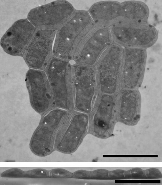 Плоская колония цианобактерий Synechococcus, внизу – поперечный срез. Цена деления шкалы: 5 мкм.