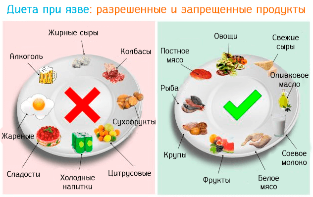 Лечебное питание — стол №1 для лечения гастрита и язвы | НАПАРУ