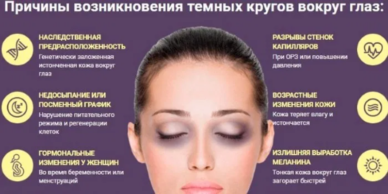 Причин много, выявить их поможет специалист.