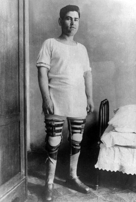 Современные протезы ног спортивные. Современные протезы ног. Остаться без конечностей. Остаться без конечностей. Остаться без конечностей.