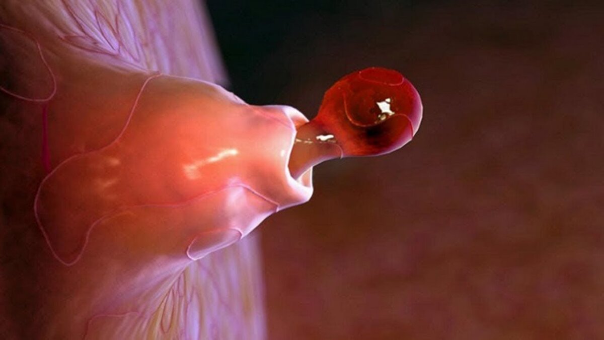 как формируется сперма в организме фото 65