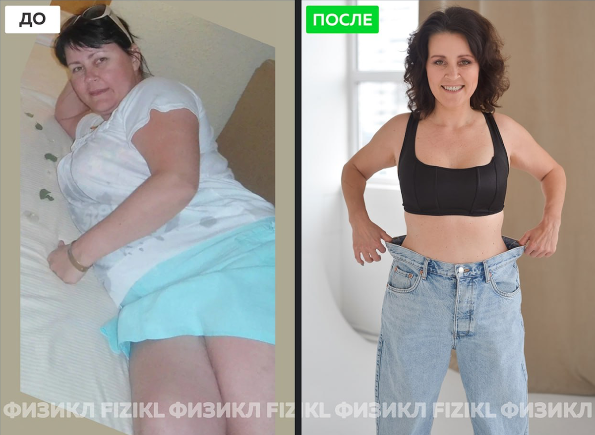 Физикл зингилевский. Физикл