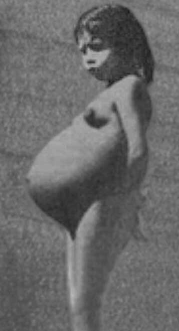 Лина Медина.