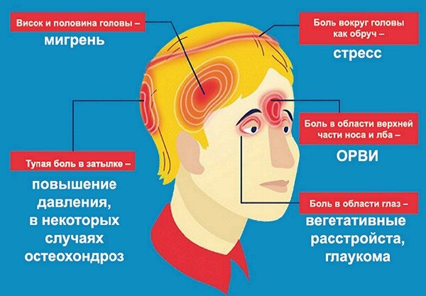 На какие болезни указывает боль в той или иной части головы.