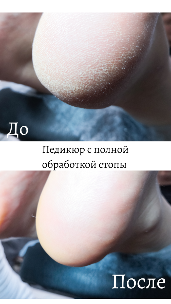  Педикюр с полной обработкой стопы