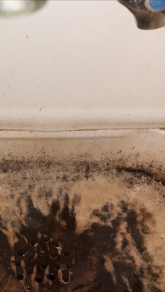 Ретрораковина.