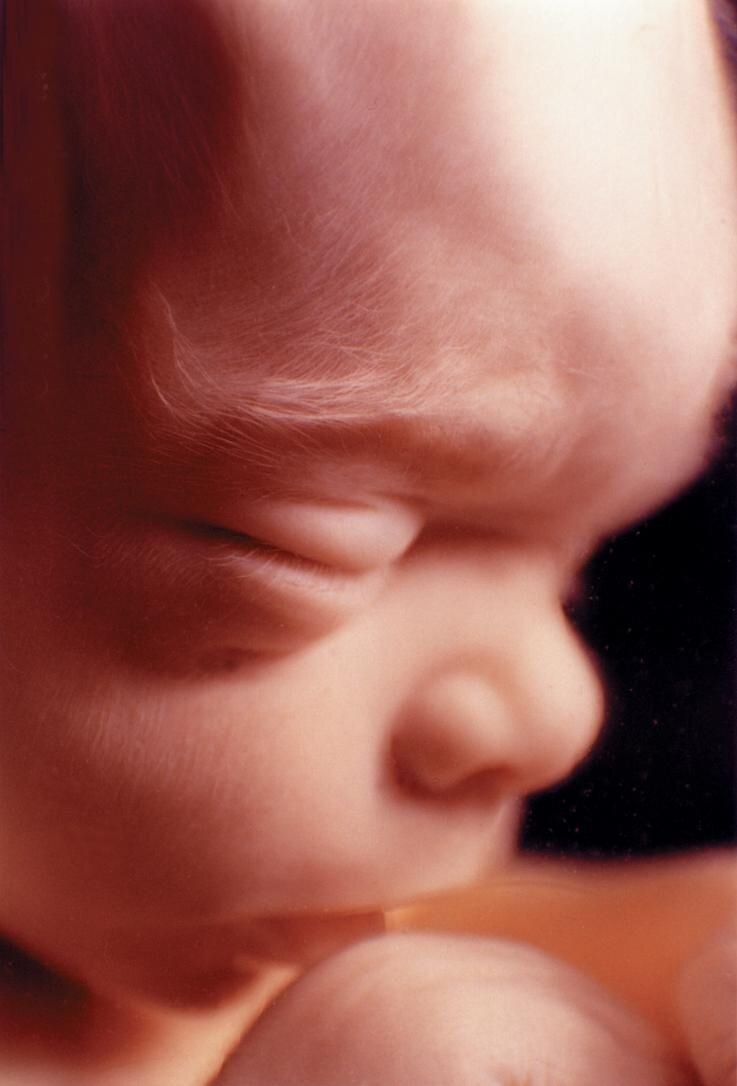 Ребенок в 22 недели беременности фото как выглядит