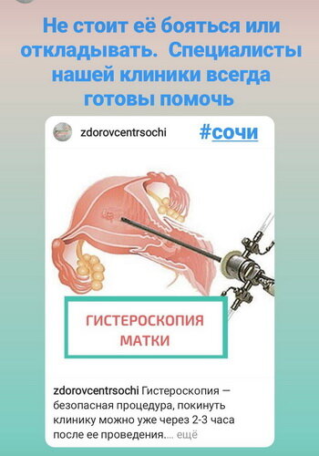 Гистероскопия под каким наркозом делают. Гистероскопия под каким наркозом делают