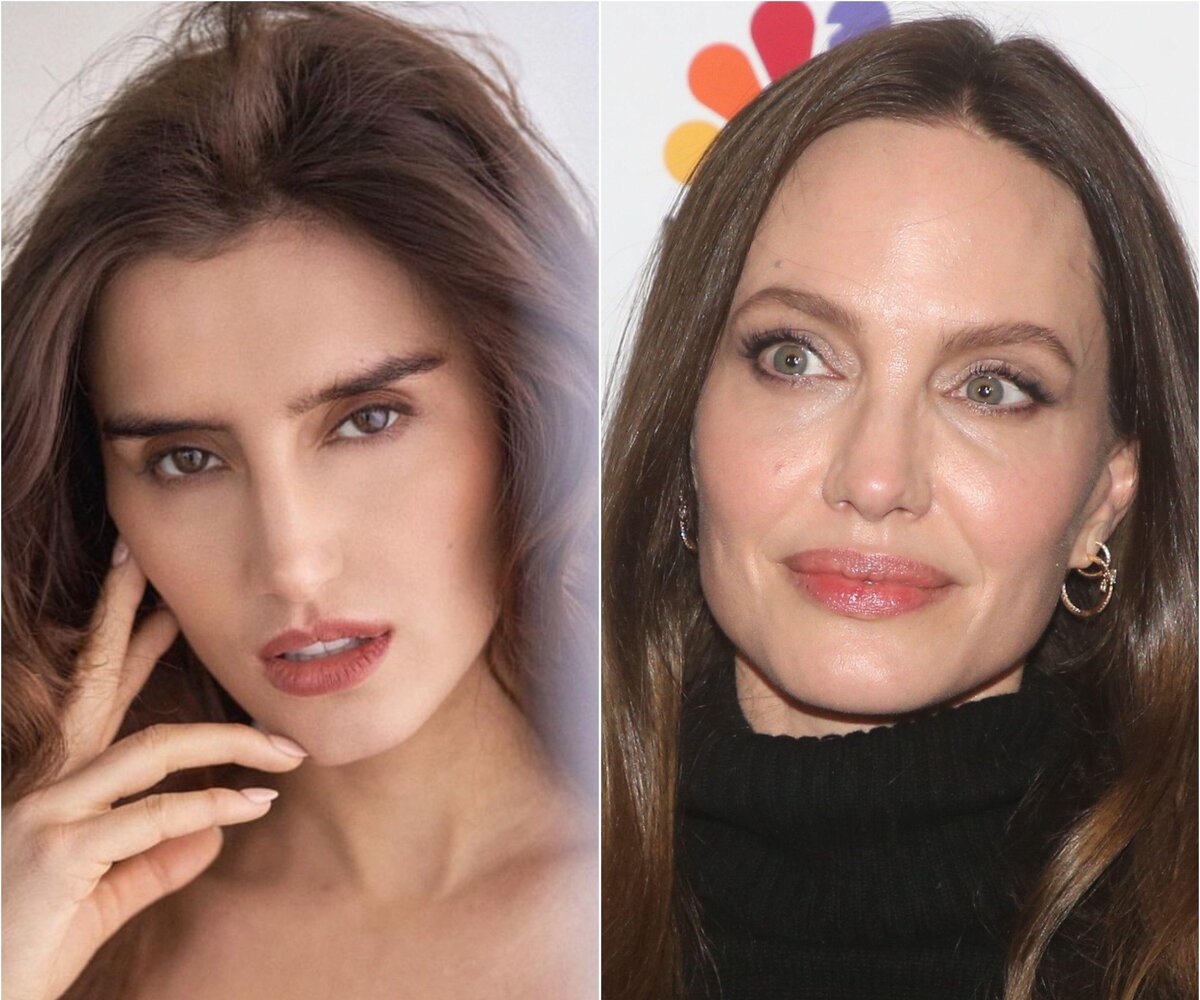     «Я удалила молочные железы из-за Анджелины Джоли»: модель сделала мастэктомию, чтобы избежать рака груди