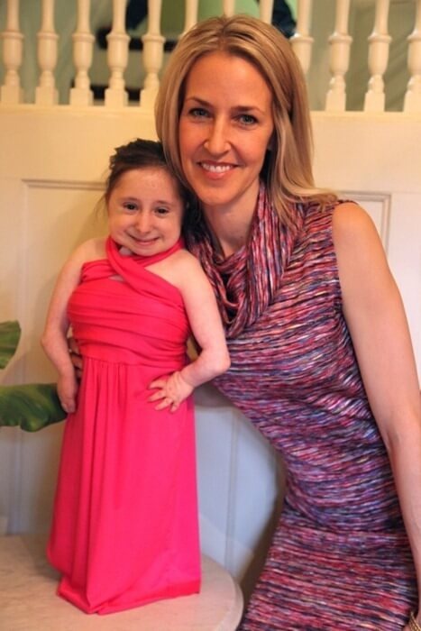 Несмотря на это Бриджит ведет полноценный образ жизни, ее увлечения — танцы и черлидинг.