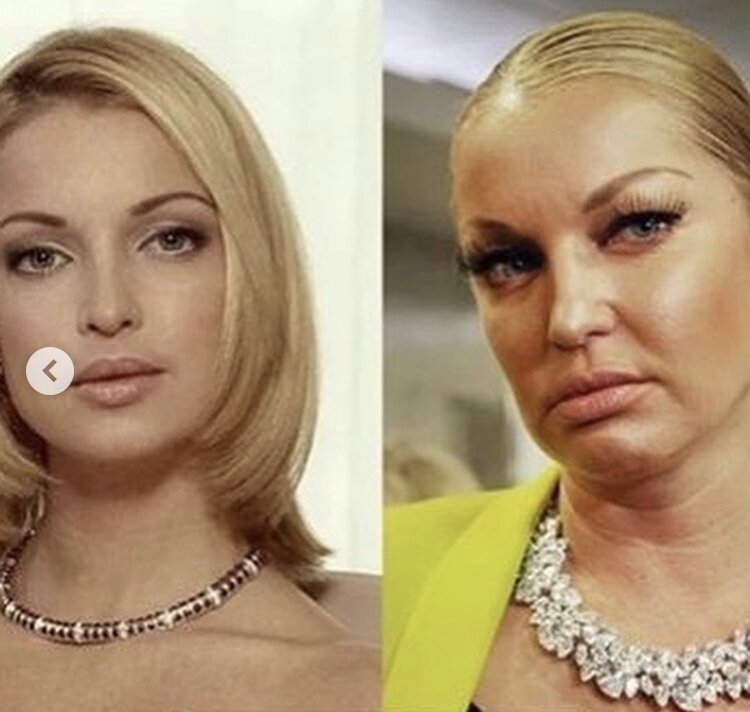 Было - Стало