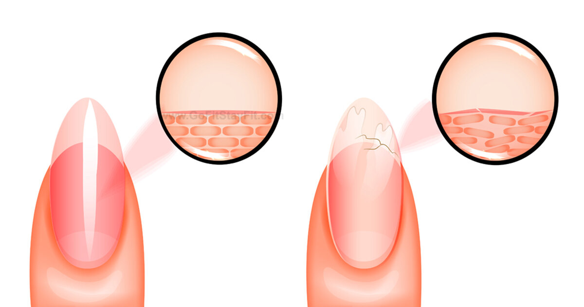 Строение ногтя и ногтевой пластины