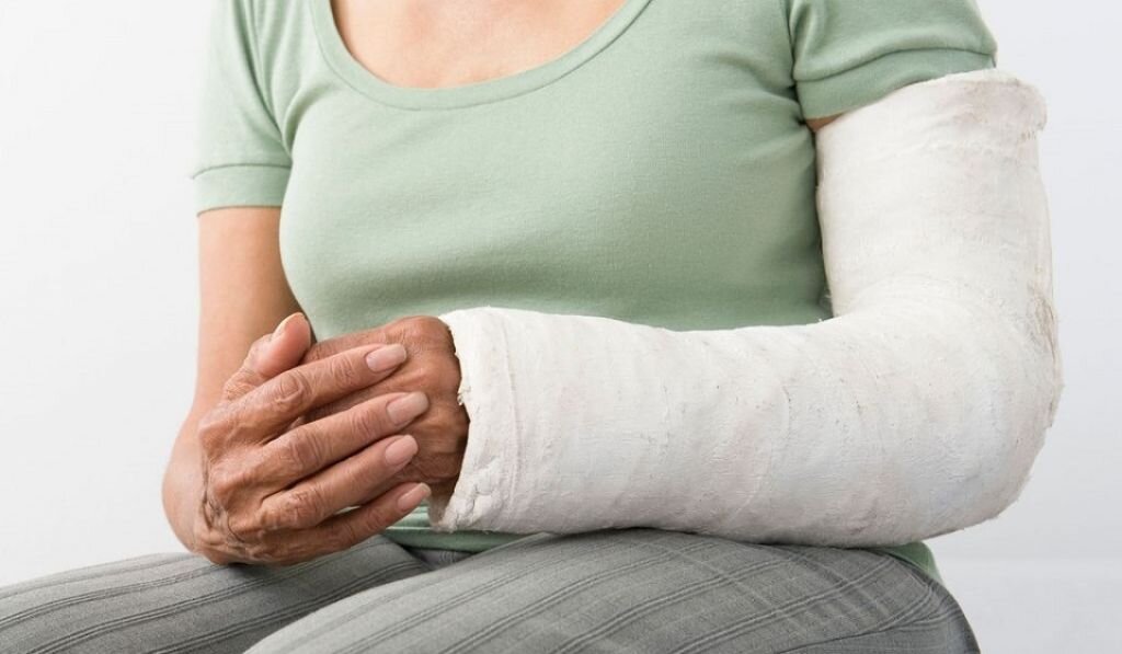 Как снять отек в гипсе. Реабилитация голеностопного сустава. Гипс при переломе наружной лодыжки. Гога после снятиягипса. Перелом ноги лодыжки в гипсе.