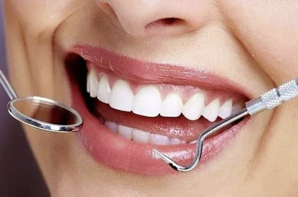 Идеальная улыбка - секреты от стоматолога