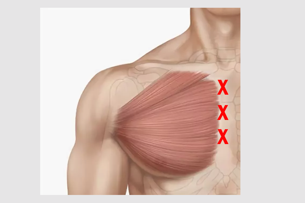 Молочные мышцы. Большая грудная мышца. Разрыв мышц грудной клетки.