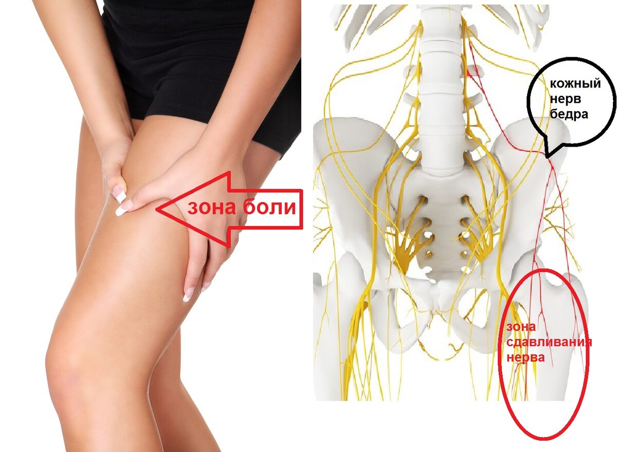 Тянущая боль в бедре, ягодице и паху - диагностика и лечение в Москве | Клиника Доктора Длина
