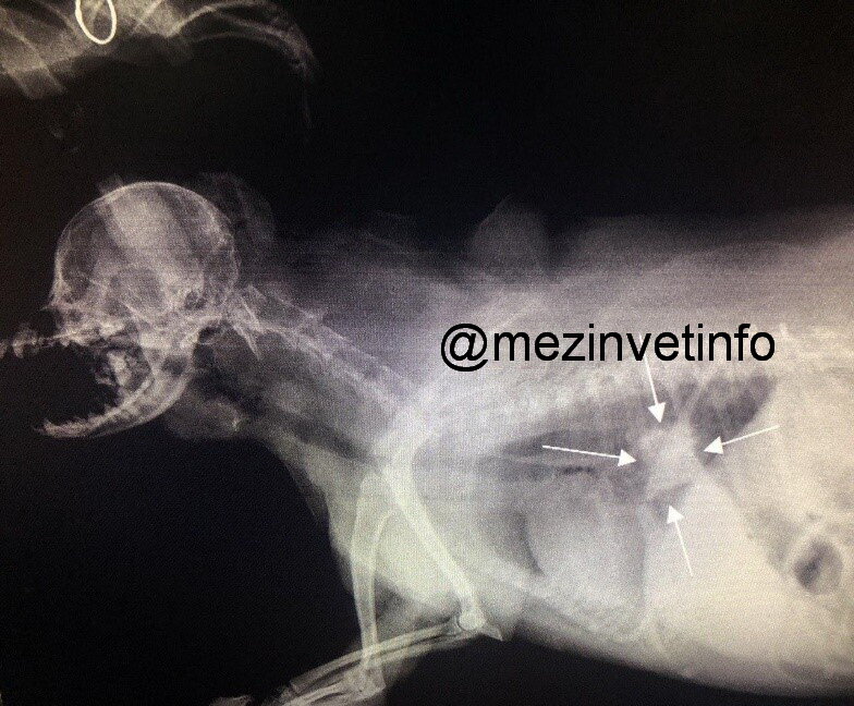 Инородные предметы в пищеводе.