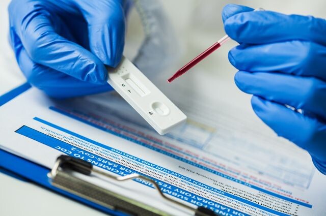 Тест на вирус. Какие исследования проводят для выявления COVID-19?Подробнее