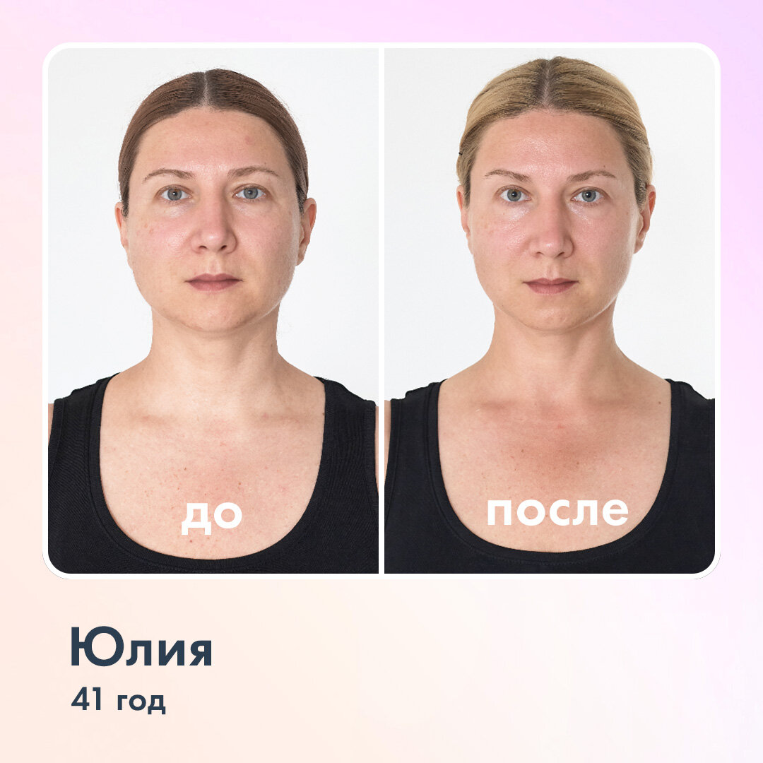 Фото сделаны и предоставлены пользователем Ревитоники