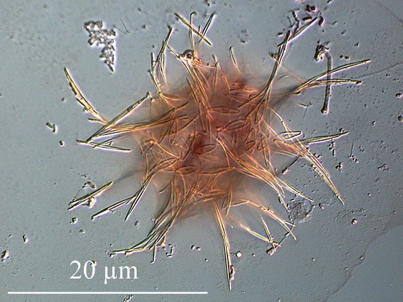    Raphidocystis sp./ © Flickr