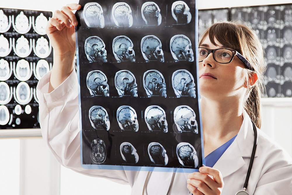 Uneori, medicul dumneavoastră local sau alt specialist vă va trimite la un neurolog.  Dar de ce se face asta? -6