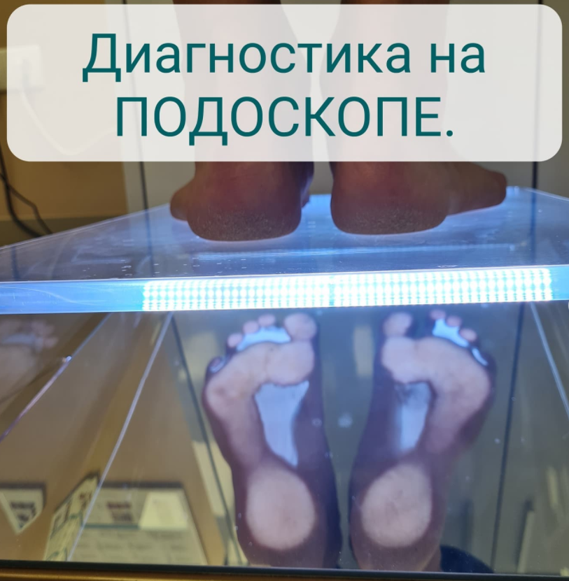 Диагностика на подоскопе. Мы можем сравнить отпечаток стопы с неким эталоном, и определить насколько он отличается от нормы.