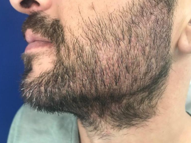 Фотография взята из источника obritye.ru