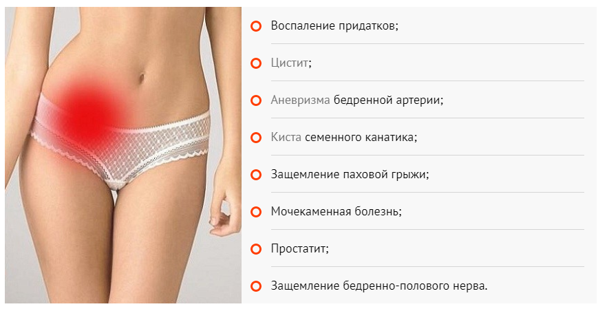 Форум низ живота