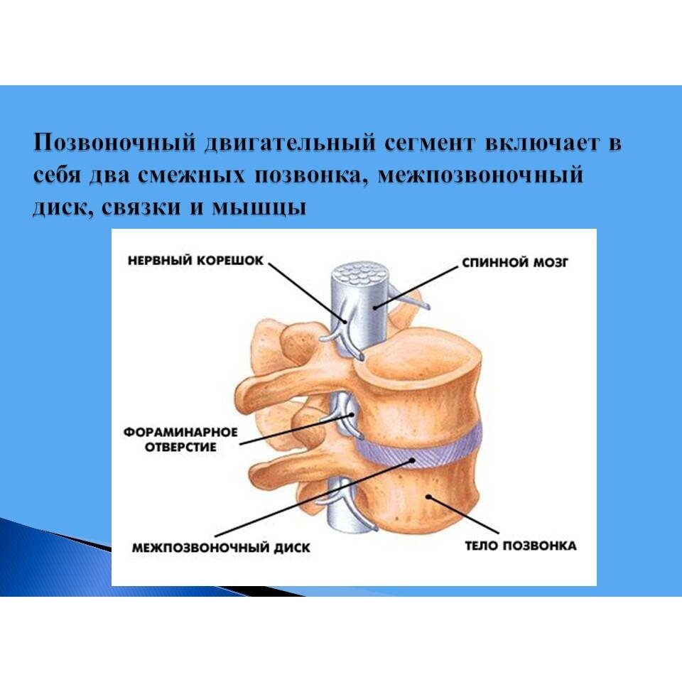 Грыжа шейного отдела позвоночника