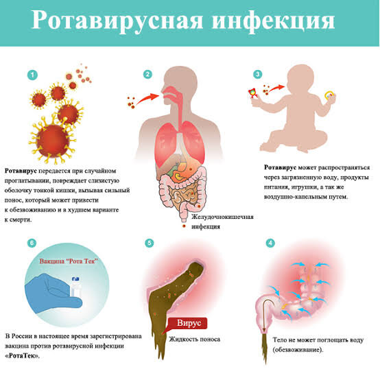 Причины ротавирусной инфекции