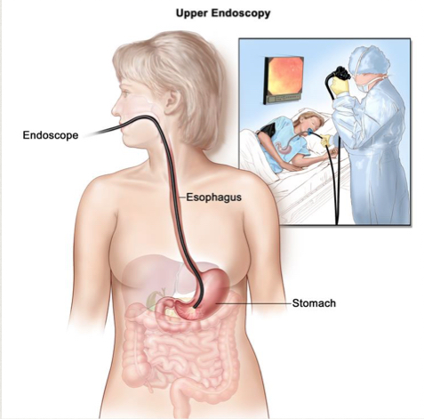 Схема проведения гастроскопии